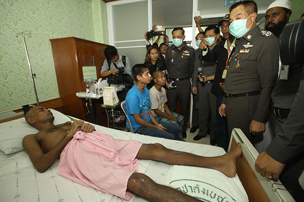 National police chief Somyot Pumpunmuang (right) visits a Rohingya migrant who survived and was rescued from a human-trafficking camp at a hospital in Songkhla province on Monday. (Photo by Pornprom Satrabhaya) National police chief Somyot Pumpunmuang (right) visits a Rohingya migrant who survived and was rescued from a human-trafficking camp at a hospital in Songkhla province on Monday. (Photo by Pornprom Satrabhaya)