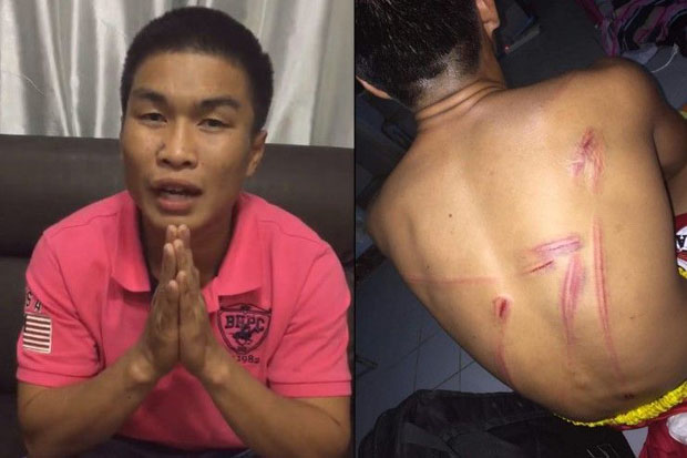 Muay Thai boxer brutalised after alleged match-fixing