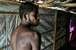 Bangkok Post - Year of abuse: Rohingya scars testify against Myanmar