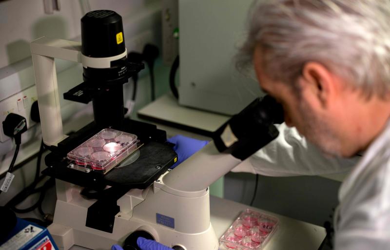 Dr Paul McKay, who is working on an vaccine for the 2019-nCoV strain of the novel coronavirus, poses for a photograph using a microscope to look at bacteria containing coronavirus DNA fragments, in a research lab at Imperial College School of Medicine (ICSM) in London on Feb 10, 2020. (AFP file photo) Dr Paul McKay, who is working on an vaccine for the 2019-nCoV strain of the novel coronavirus, poses for a photograph using a microscope to look at bacteria containing coronavirus DNA fragments, in a research lab at Imperial College School of Medicine (ICSM) in London on Feb 10, 2020. (AFP file photo)