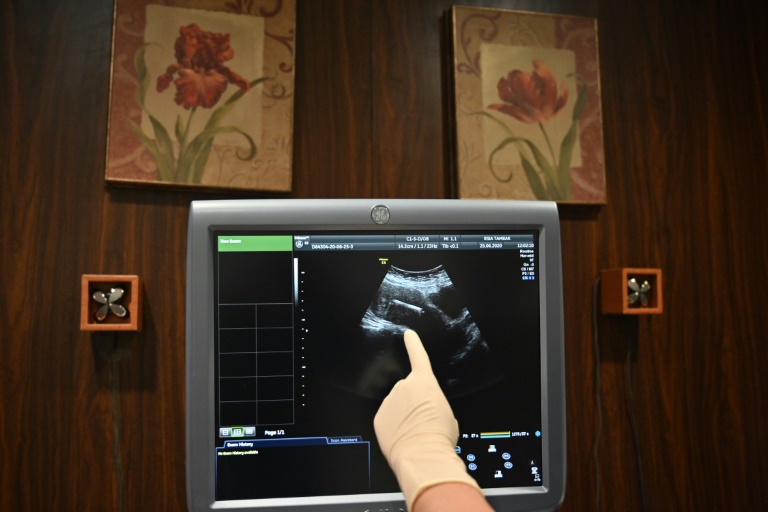Indonesian authorities believe there could be 400,000 more births than usual next year as lockdowns keep couples at home and cut access to contraception. Indonesian authorities believe there could be 400,000 more births than usual next year as lockdowns keep couples at home and cut access to contraception.