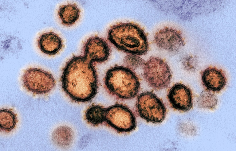 Virus mutations down to chance, in more ways than one