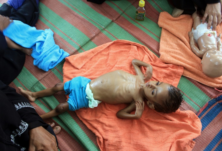 Tens of thousands of people have been killed and millions pushed to the brink of famine in the six-year-old Yemen conflict, which the UN describes as the world's worst humanitarian crisis. Tens of thousands of people have been killed and millions pushed to the brink of famine in the six-year-old Yemen conflict, which the UN describes as the world's worst humanitarian crisis.