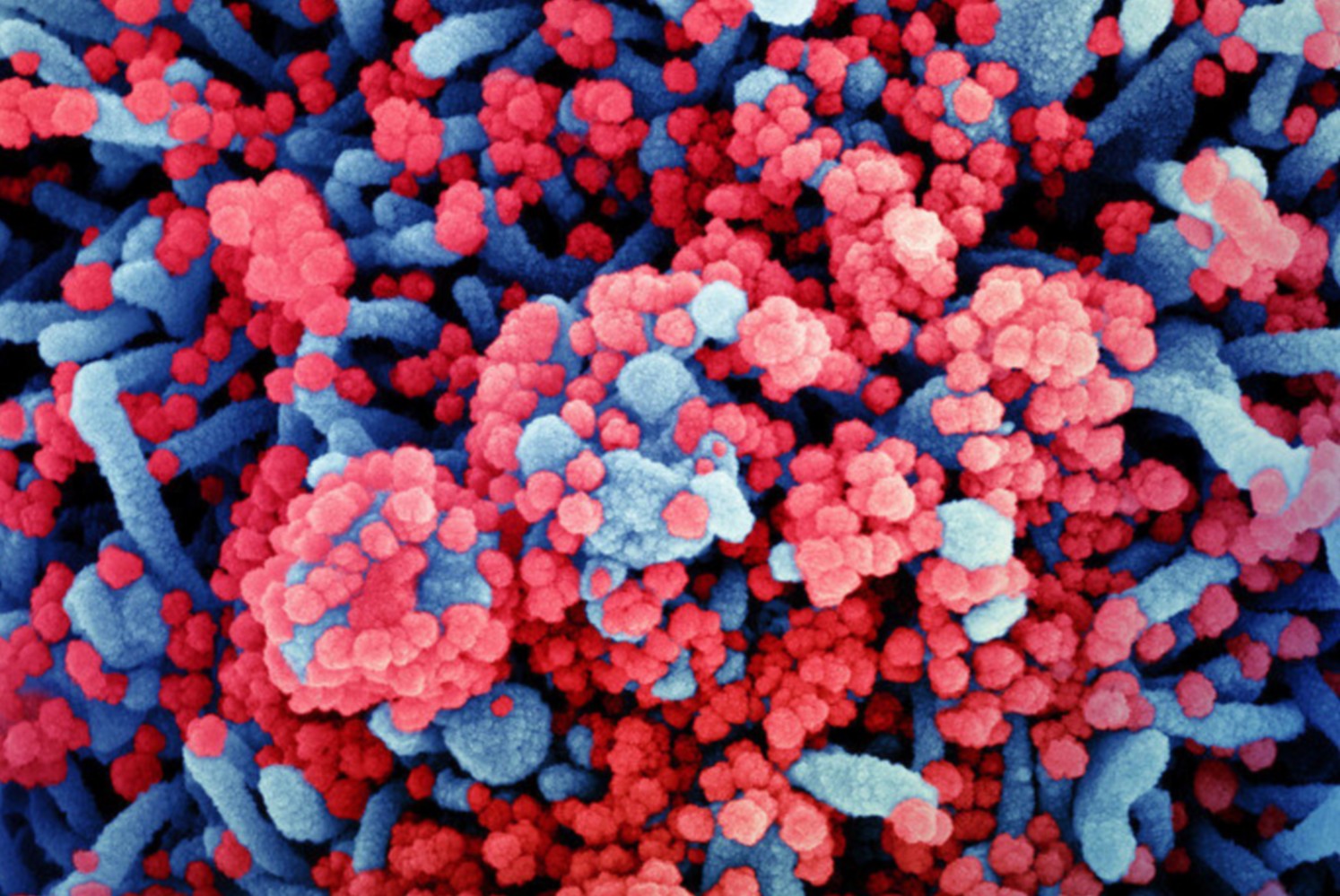 Colorized scanning electron micrograph of a cell (blue) heavily infected with SARS-CoV-2 virus particles (red), isolated from a patient sample. Image captured at the NIAID Integrated Research Facility (IRF) in Fort Detrick, Maryland, USA. (Image: NIAID) Colorized scanning electron micrograph of a cell (blue) heavily infected with SARS-CoV-2 virus particles (red), isolated from a patient sample. Image captured at the NIAID Integrated Research Facility (IRF) in Fort Detrick, Maryland, USA. (Image: NIAID)
