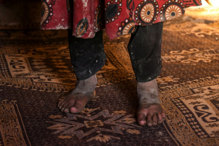 Hunger forces Afghans to sell young daughters into marriage - Vimarsana News