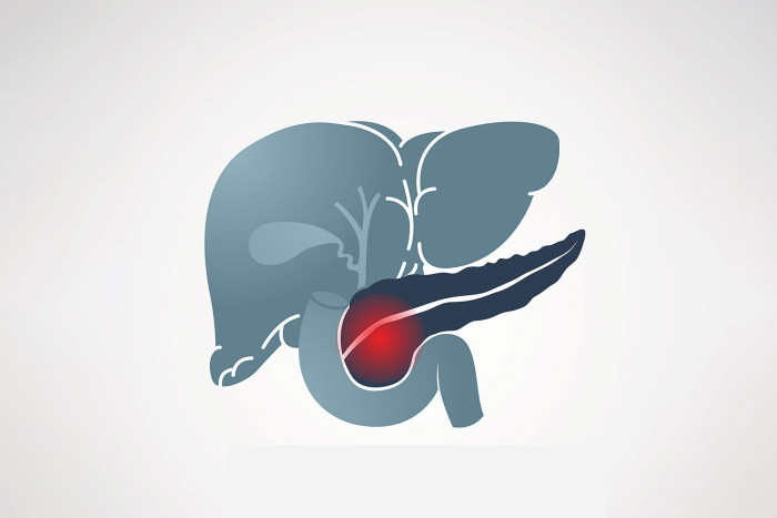 Pancreatic cancer is almost impossible to detect early - Vimarsana News