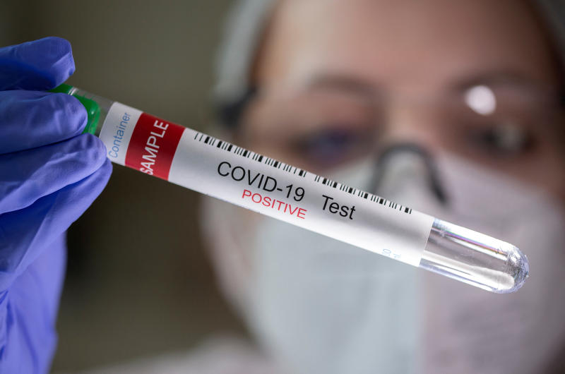 A test tube labelled "Covid-19 Test positive" is seen in this illustration picture. (Reuters photo)