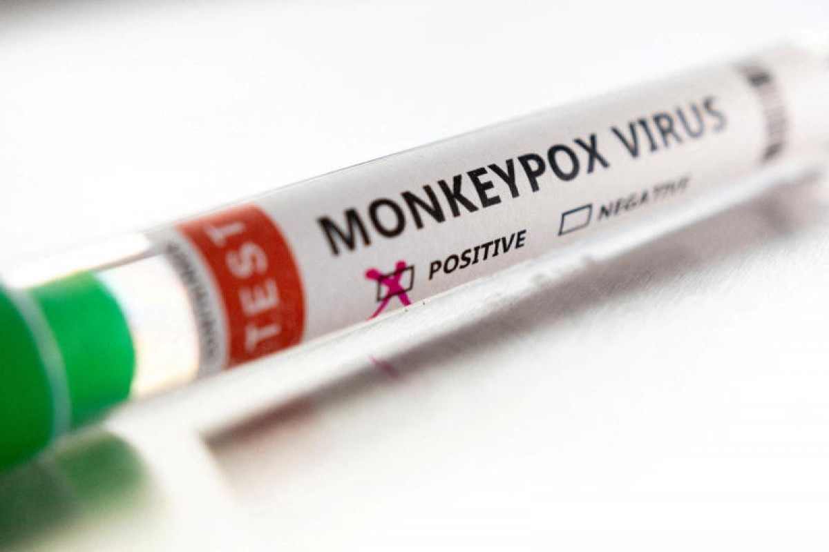 Bangkok Post - Singapore confirms first local case of monkeypox infection