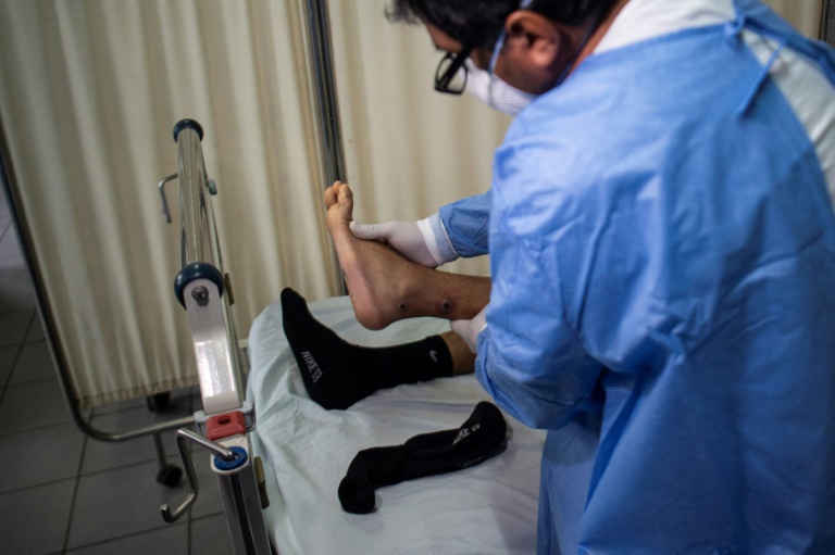 A doctor checks on a patient with sores caused by monkeypox. A doctor checks on a patient with sores caused by monkeypox.