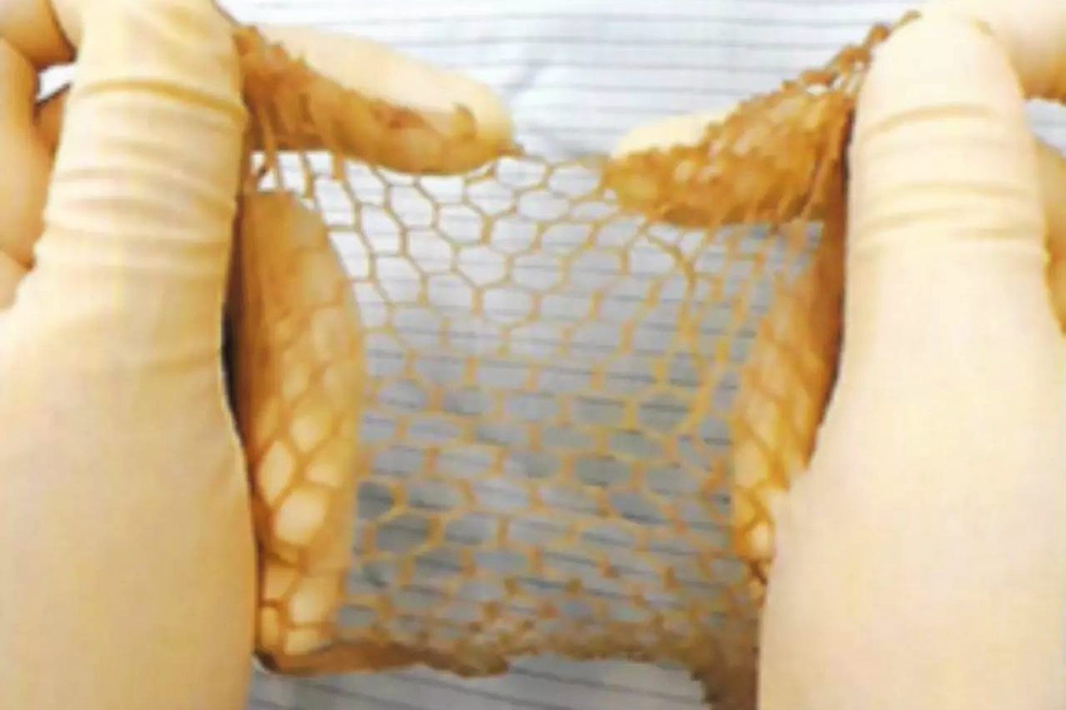 Meshed human skin.