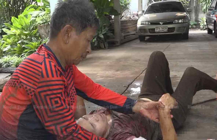 Woman attacked by her pitbull