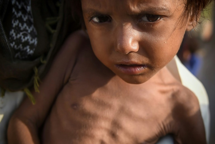 After floods, disease wave plagues Pakistan - Vimarsana News