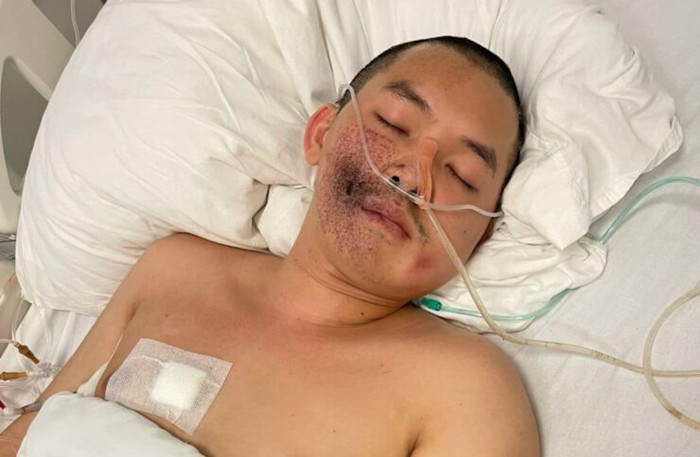Shot Lao activist confirmed to be still alive - Vimarsana News