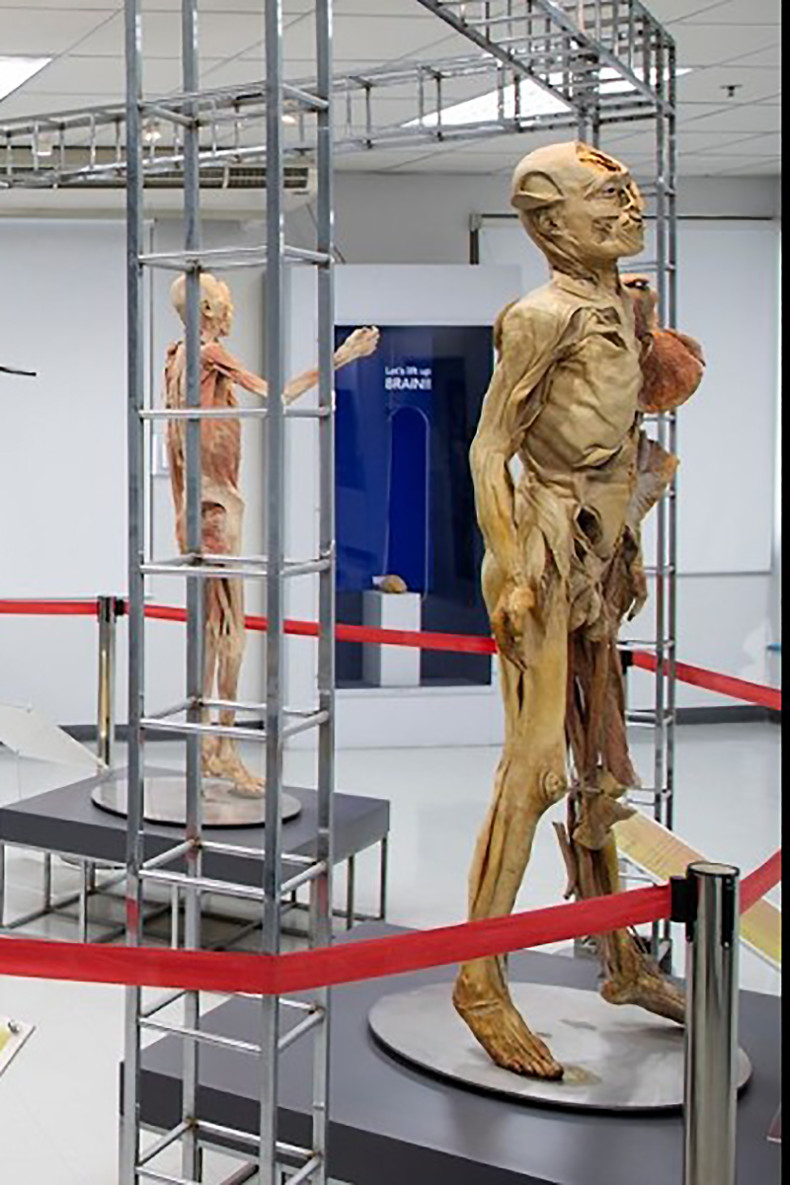 See anatomy like never before at Bangkok's Museum of Human Body