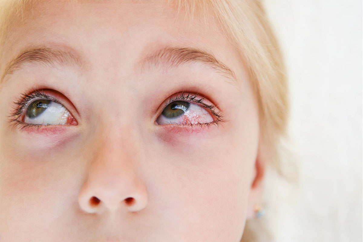 'Floaters' do not pose a risk to your eye health