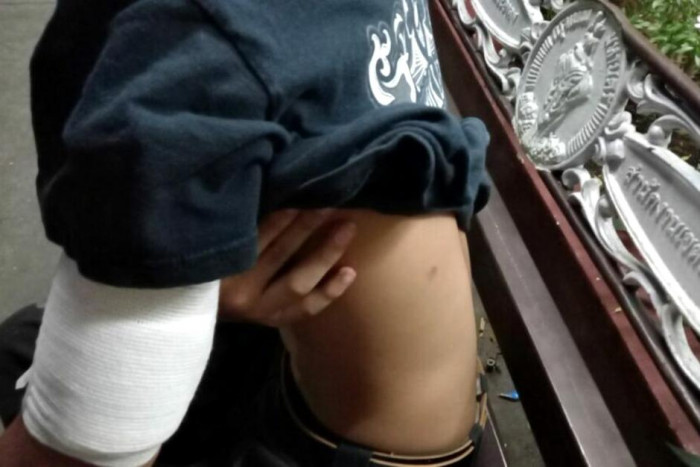 Marauding teens, dangly-bits thief, cheeky druggie - Vimarsana News