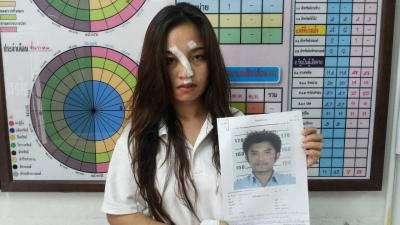 หนุ่มแค้นถูกแฟนสาวบอกเลิก คัตเตอร์กรีดหน้าเหวอะ 78 เข็ม