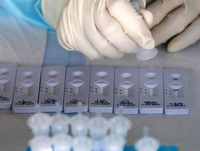 ตรวจโควิดแบบ Rapid Antigen Test เป็นวันแรก
